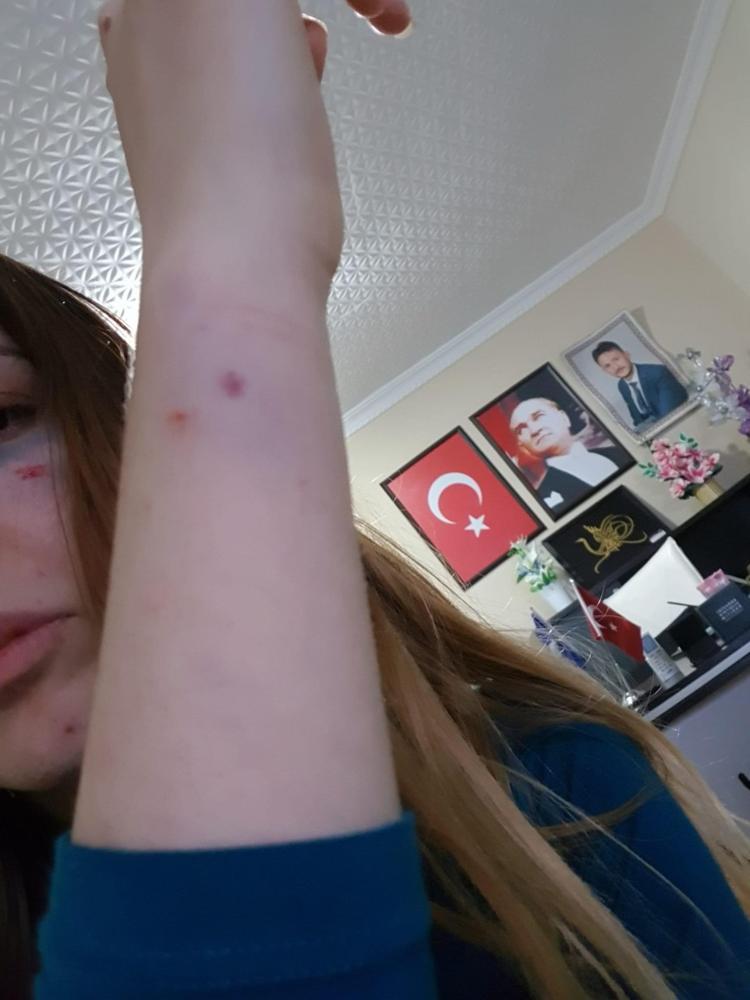 Hastalıklı ilişki Muhtardan eski sevgilisine çıplak fotoğraf şantajı