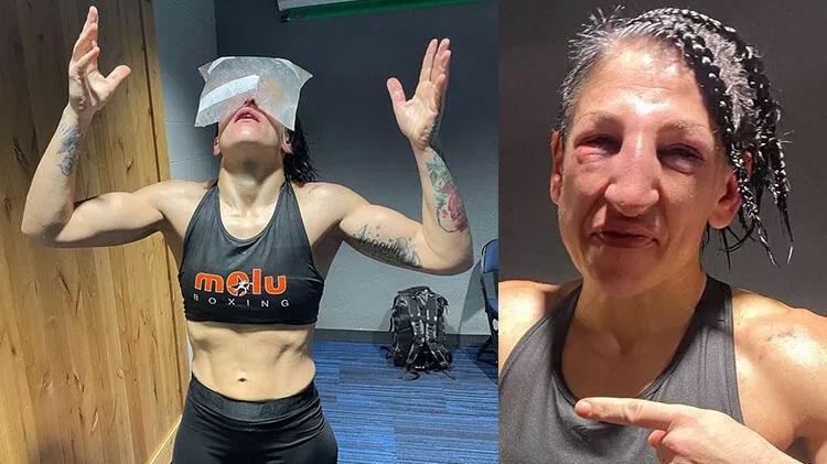 Dünya şampiyonu Amanda Serrano Miriam Gutierrezi tanınmaz hale getirdi 237 yumruk sonrası...