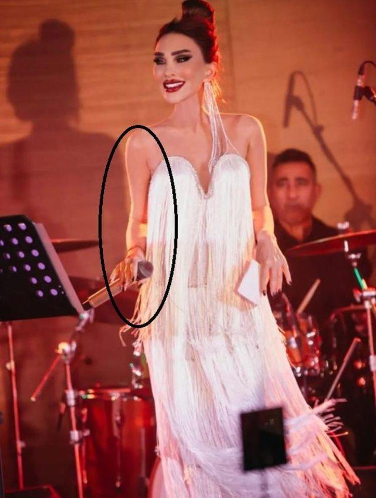 Seren Serengil sahneden paylaştı Hemen sil, koluna ne olmuş öyle