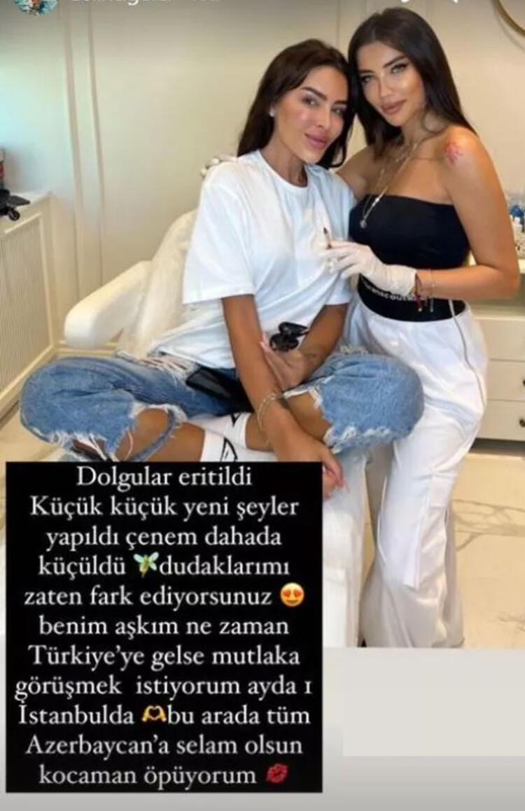 Selin Ciğerciden estetik paylaşımı: Dudaklarımı zaten fark ediyorsunuz