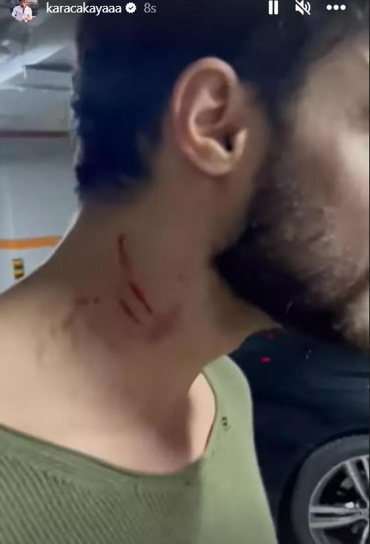Batuhan Karacakaya ile Ayşe Aslanpay arasında video savaşları