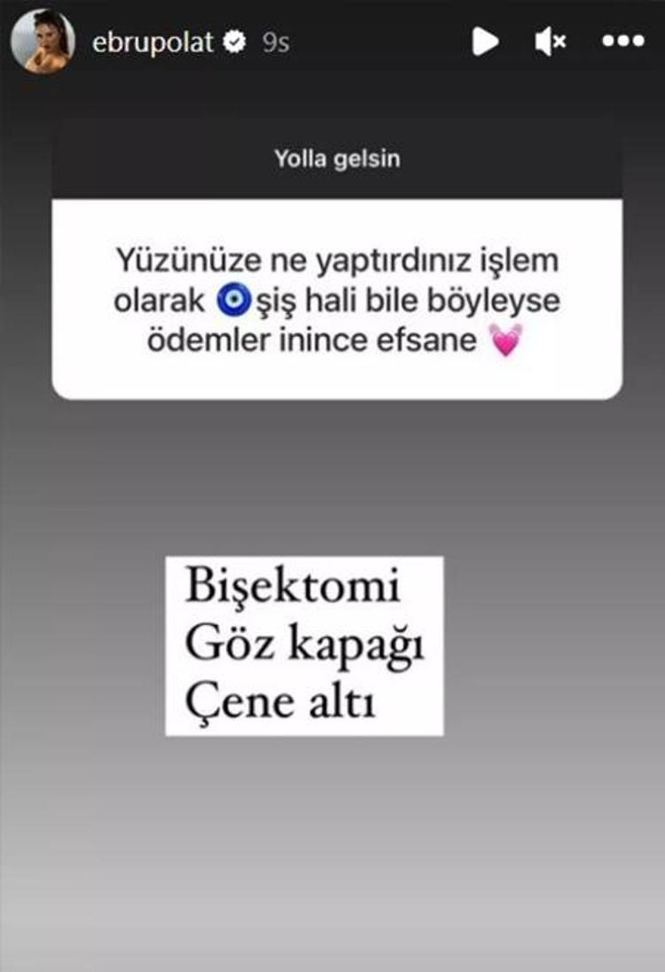 Estetikli ünlüler kervanına katılan Mahmut Tuncer: Ivana geleceği görmüş
