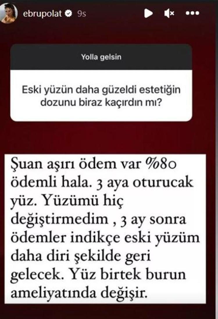 Estetikli ünlüler kervanına katılan Mahmut Tuncer: Ivana geleceği görmüş