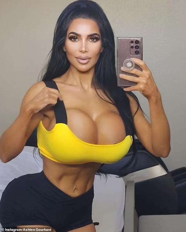 Kim Kardashian’a benzeyebilmek için yapmadığı estetik kalmadı Sonu kötü bitti