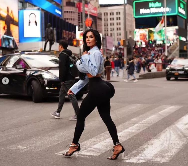 Kim Kardashian’a benzeyebilmek için yapmadığı estetik kalmadı Sonu kötü bitti