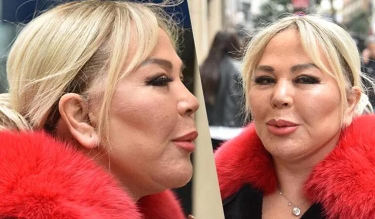 Seda Sayan estetiğe doymuyor Yine bıçak altına yattı