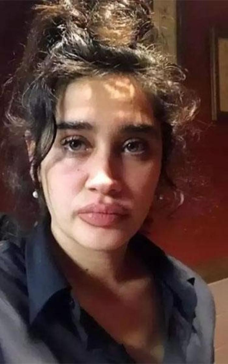 Meltem Miraloğludan şaşırtan poz 84 yaşındaki Patrick Grady ile evliliği çok konuşulmuştu