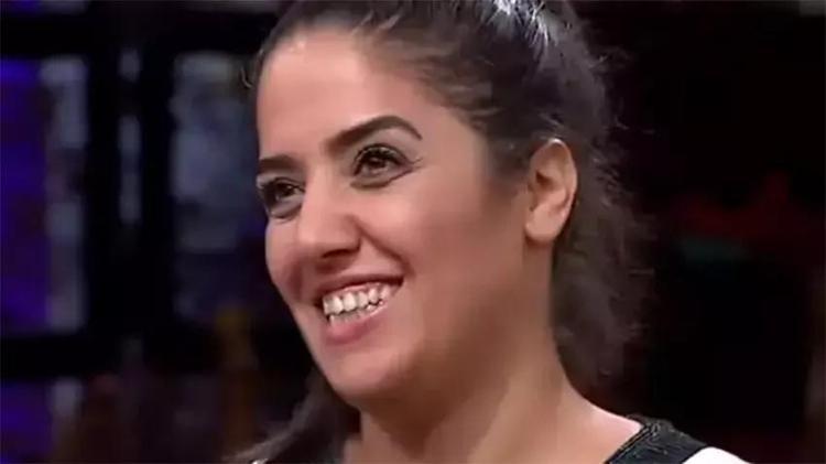 MasterChef Azizenin ilk halini gören unutamıyor MasterChef Azize hangi estetikleri yaptırdı