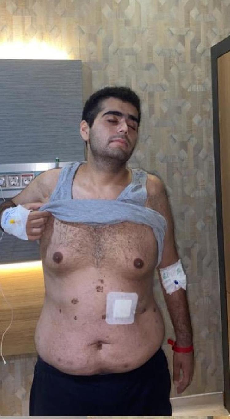 Mide küçültme ameliyatı hayatını kabusa çevirdi Ölümden döndü