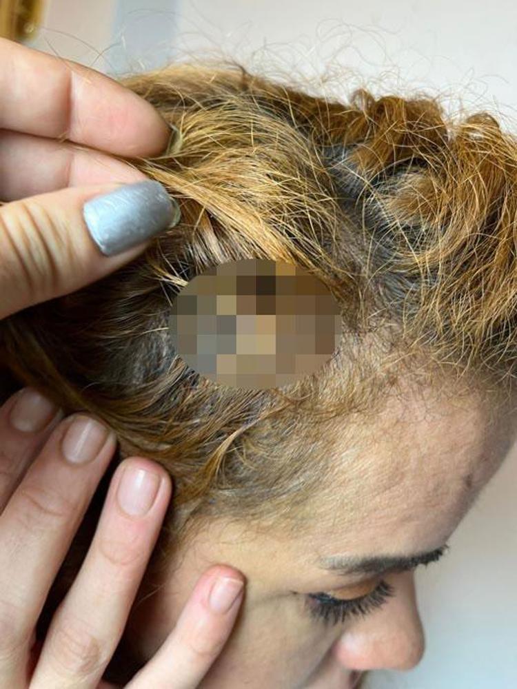 Taksim’de genç çifte çivili sopalı saldırı Öldüresiye dövdüler