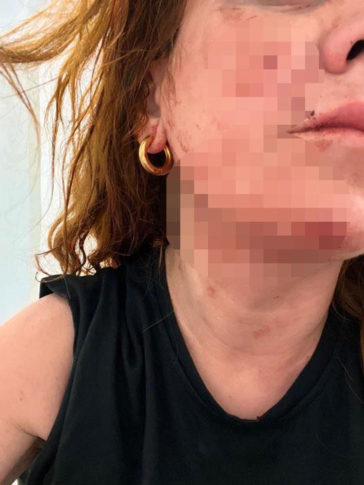 Taksim’de genç çifte çivili sopalı saldırı Öldüresiye dövdüler