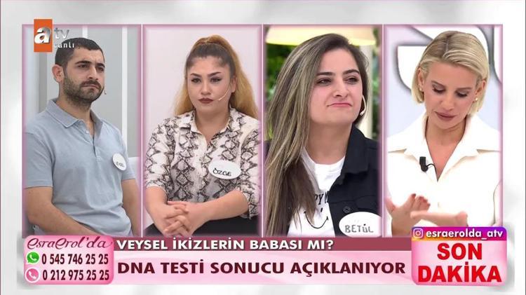 İkiz bebeklerin babaları farklı olabilir mi (babaları farklı nasıl olur) Heteropaternal Süperfekondasyo nedir İkiz bebeklerden birinin babası farklı