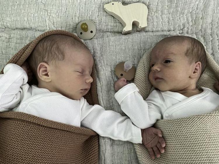 İkiz bebeklerin babaları farklı olabilir mi (babaları farklı nasıl olur) Heteropaternal Süperfekondasyo nedir İkiz bebeklerden birinin babası farklı