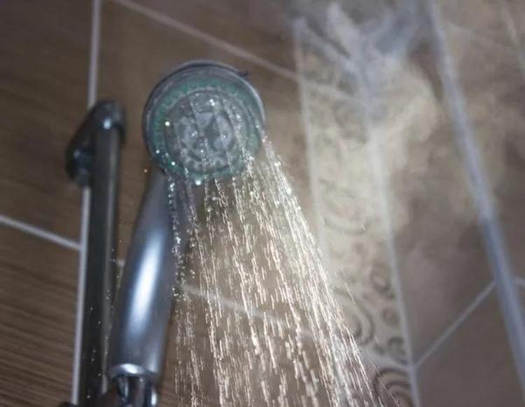 Bu hata saç derisinde yaralara neden oluyor Banyodan çıktığınız anda kepek oluyorsa dikkat