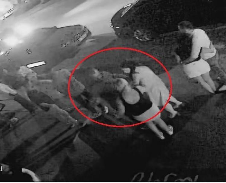 Kafa attı vücudunda sigara söndürdü Eski sevgili dehşeti kan dondurdu