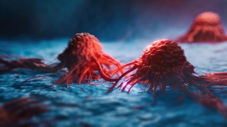 Kanser açıklaması: 2050’ye kadar 35 milyondan fazla yeni kanser vakası görülecek