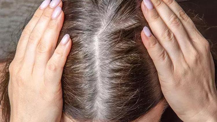 Saçlarınız yaş aldıkça beyazlaşmıyor: Yemeklerden bunları eksik etmeyin, sebum üretimi durmasın
