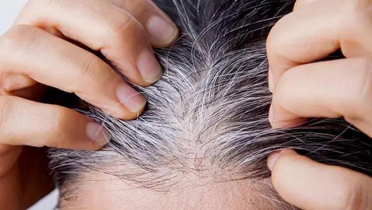 Saçlarınız yaş aldıkça beyazlaşmıyor: Yemeklerden bunları eksik etmeyin, sebum üretimi durmasın
