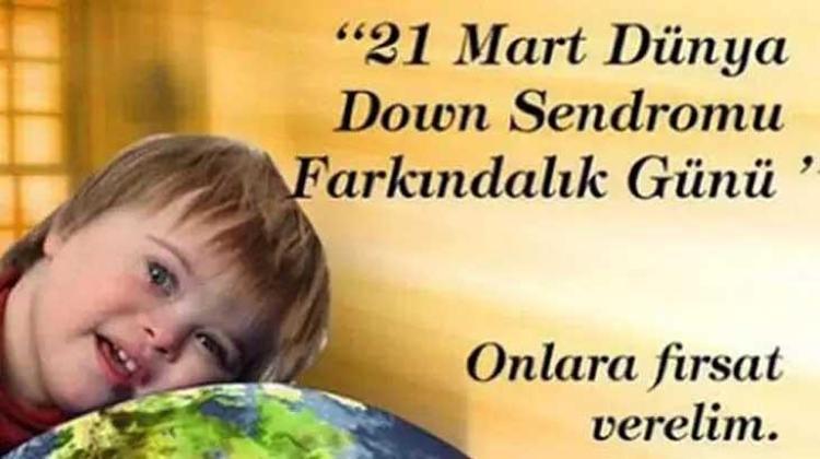 Down Sendromu Günü sözleri || Anlamlı Down Sendromu farkındalık günü ile ilgili sözler: 21 Mart Down Sendromu Farkındalık günü mesajları