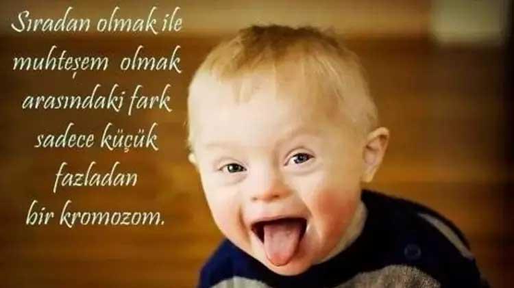 Down Sendromu Günü sözleri || Anlamlı Down Sendromu farkındalık günü ile ilgili sözler: 21 Mart Down Sendromu Farkındalık günü mesajları