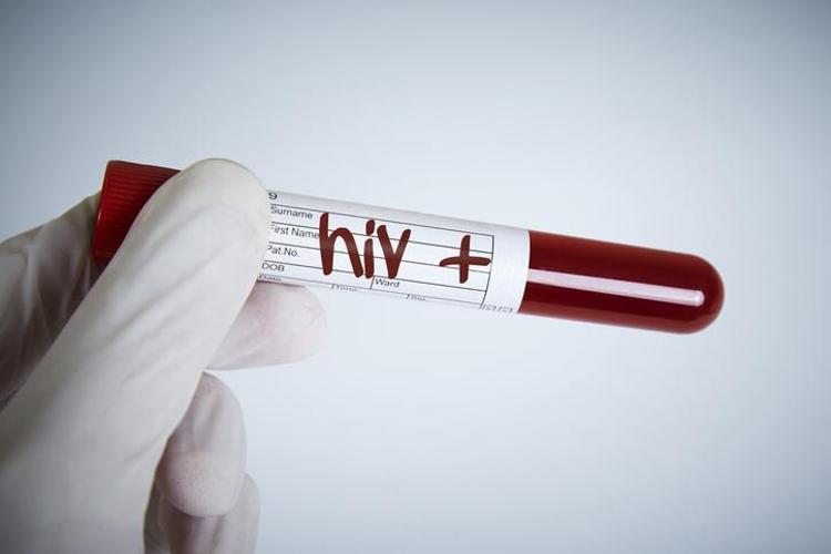 AIDS nasıl bulaşır, tedavisi var mı