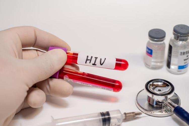 AIDS belirtileri (Erkek Kadın) AİDS hastalığı nedir, AİDS nasıl bulaşır, öldürür mü, AİDS hastalığı kan tahlili sonucunda anlaşılır mı, geçer mi, tedavisi var mı