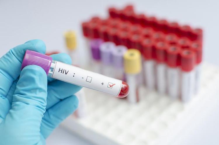 AIDS kan tahlilinde çıkar mı