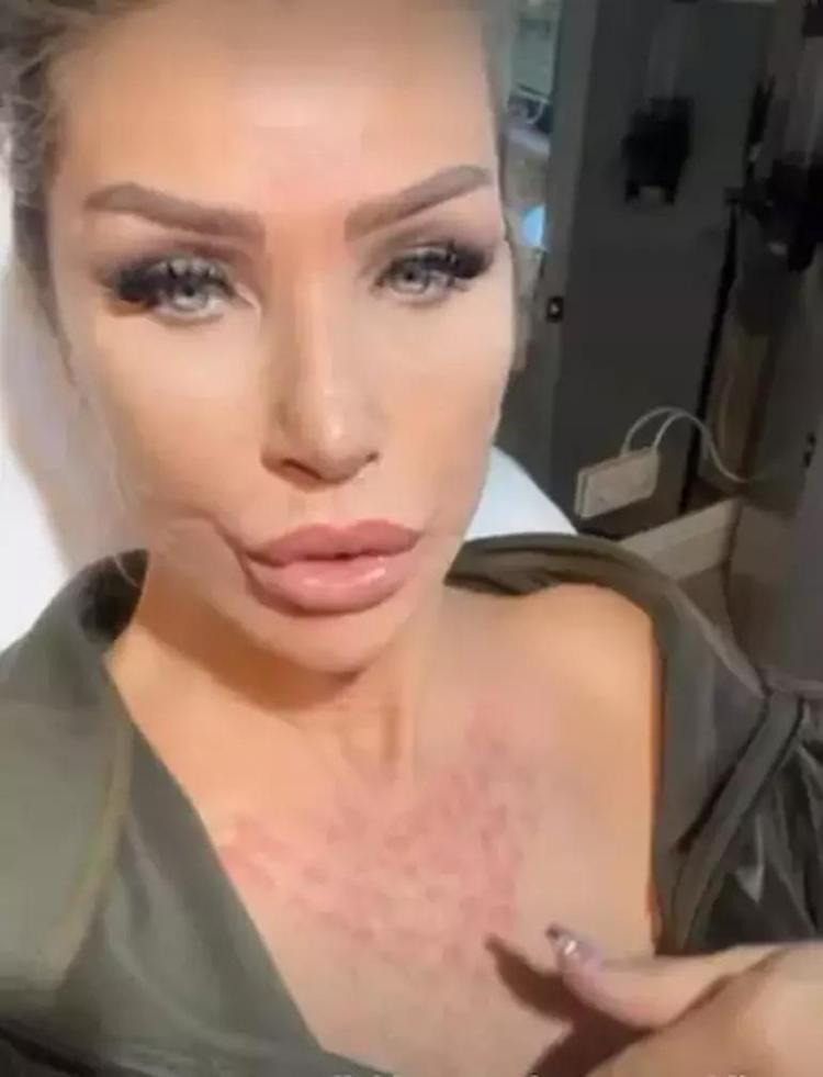 Estetikli ünlüler kervanına katılan Mahmut Tuncer: Ivana geleceği görmüş