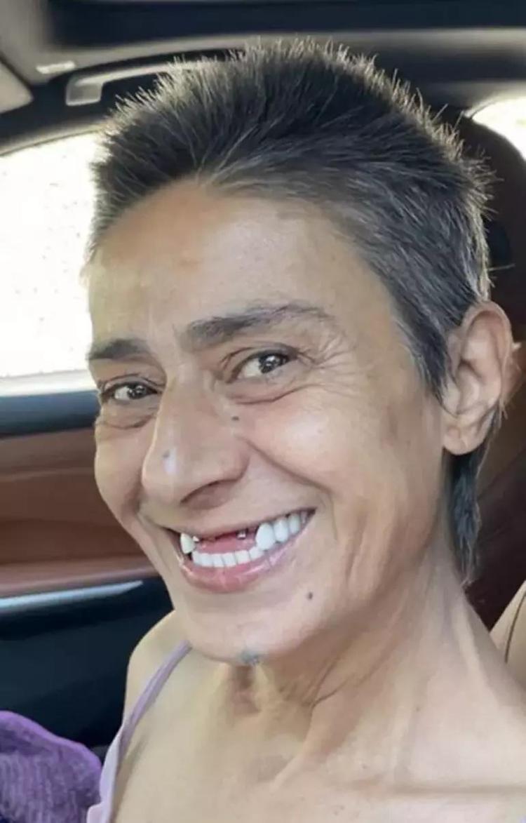 Seda Bakan da dişsiz halini paylaştı