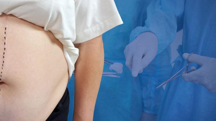Obez hastalarda da uygulanabiliyor Uzmanı açıkladı: Haftalarca beklemeye gerek yok