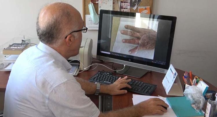 Parmağımdaki kitlenme kesilmeye başladı