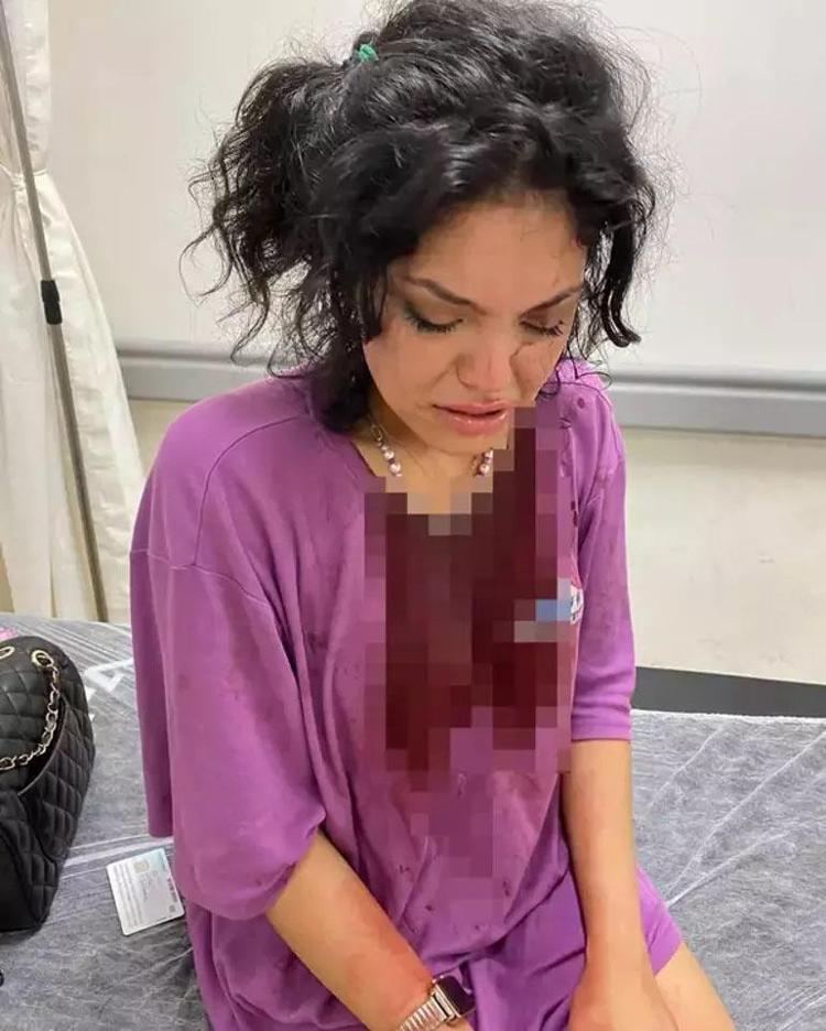 Topuklu ayakkabıyla başına vurulmuştu Eslem Sena Nur yaşadıklarını anlattı