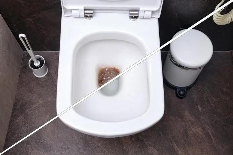 Klozet lekelerine 10 dakikada son veren tüyo; 3 malzemeli doğal çözüm…