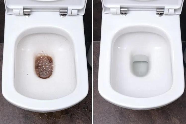 Klozet lekelerine 10 dakikada son veren tüyo; 3 malzemeli doğal çözüm…