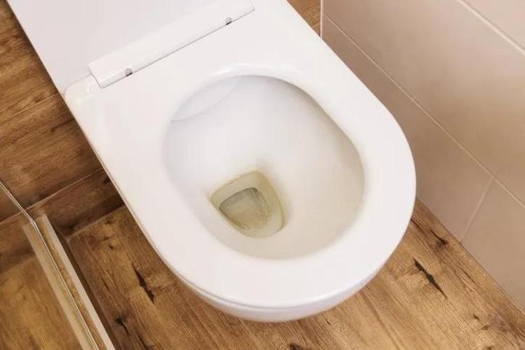 Klozet lekelerine 10 dakikada son veren tüyo; 3 malzemeli doğal çözüm…