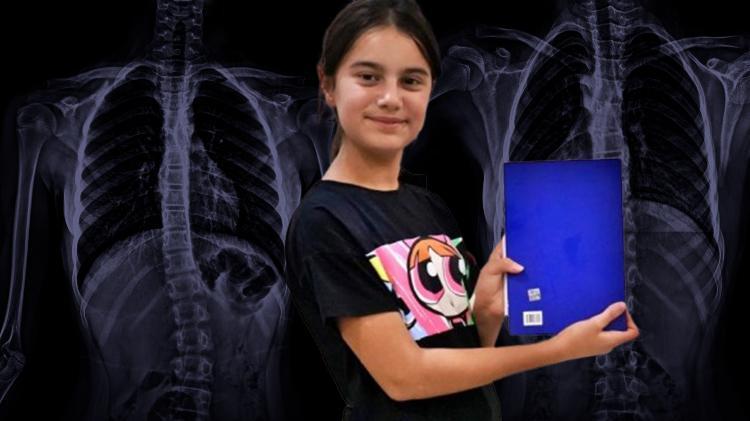 Bir kitap sayesinde ameliyat edilmekten böyle kurtuldu