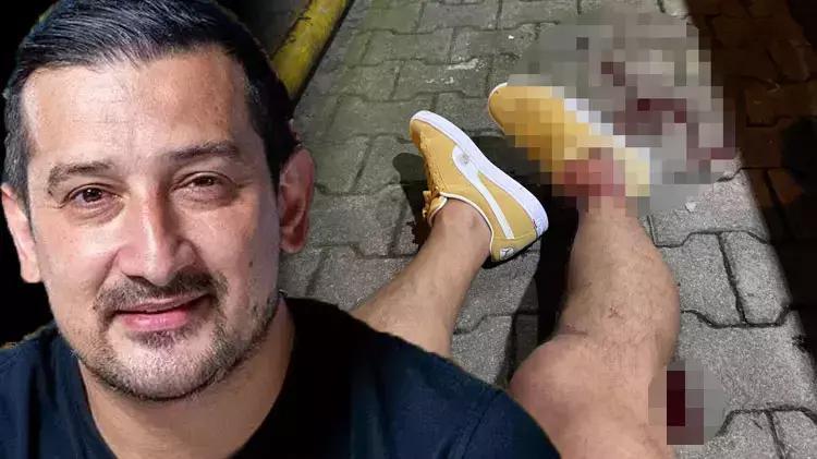 TUNCAY ŞANLI: AMELİYATA ALACAKLAR
