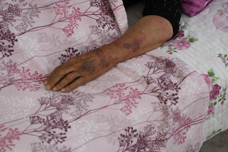 Yaşlı kadın yüzüğünü vermeyince öldüresiye dövüp banyoya kilitledi