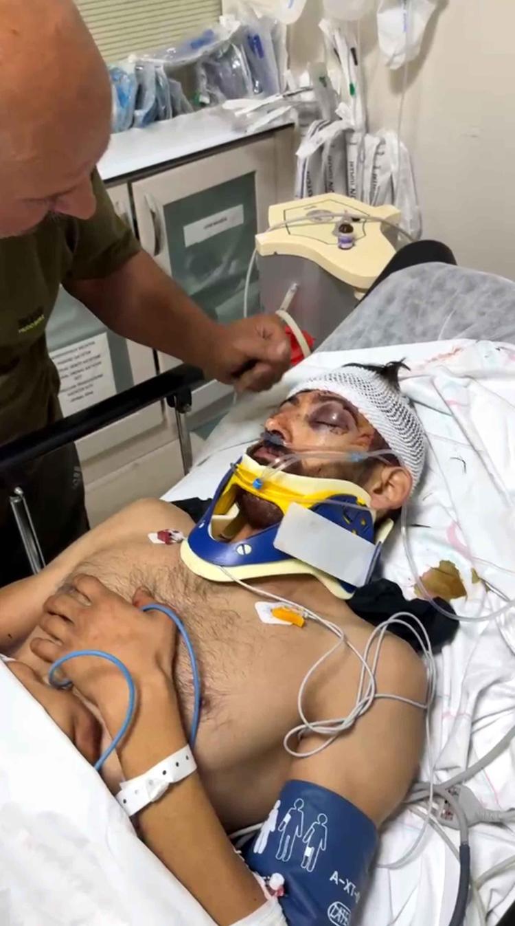 Antalyada çiçekçi dehşeti Eşinin fotoğraflarını paylaşan arkadaşını tek yumrukla komaya soktu