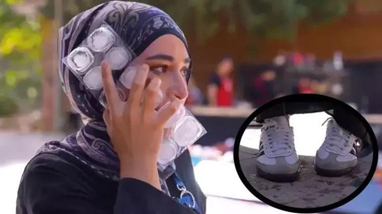 BEYZANIN YÜZÜ YANDI