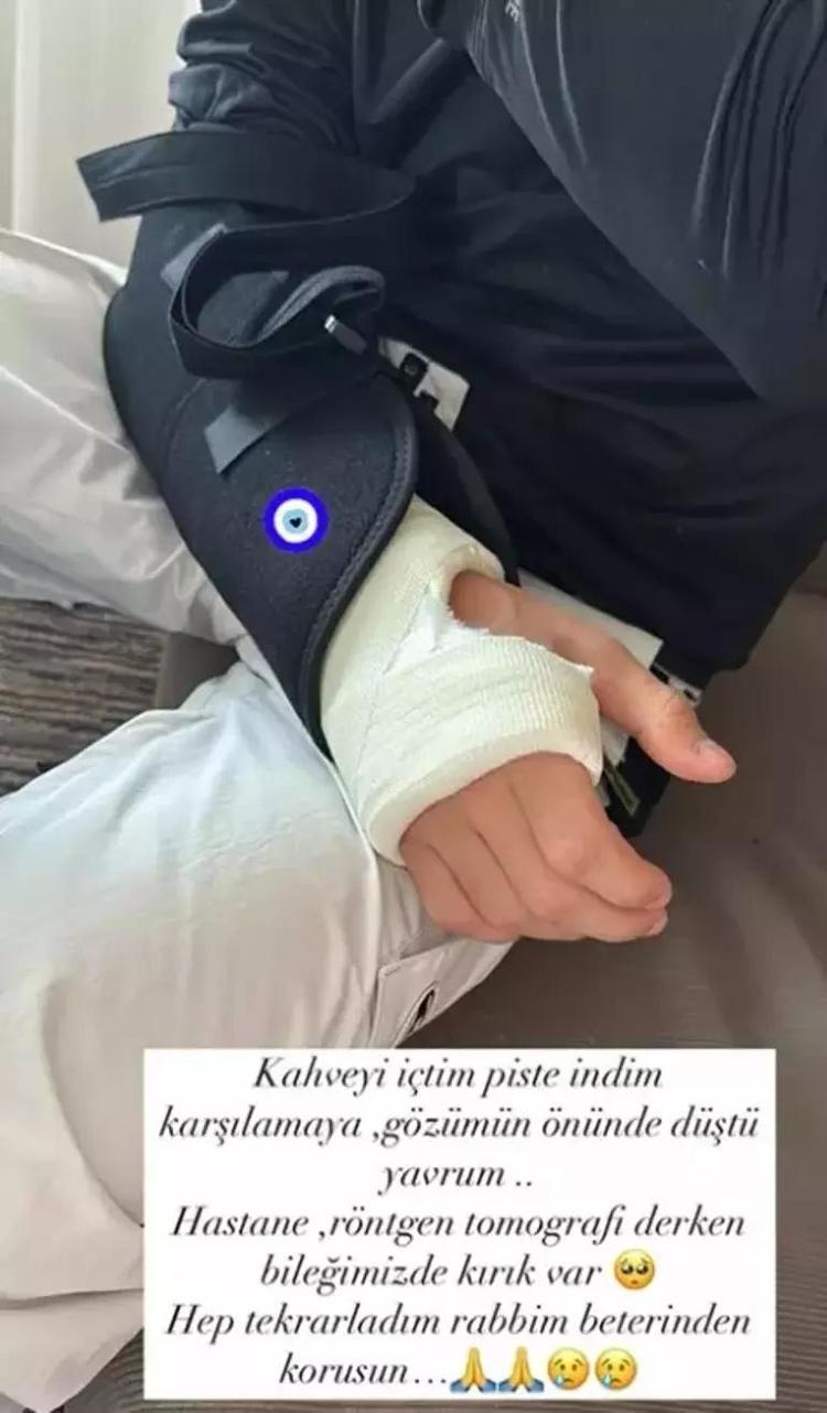 BİLEĞİMİZDE KIRIK VAR