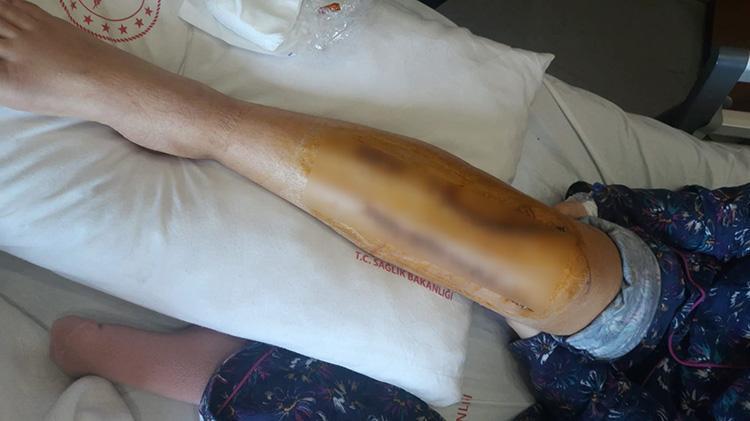 Şanlıurfada avukata korkunç saldırı Haciz işlemi için gitti, saldırıya uğradı