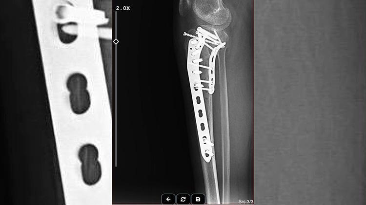 Şanlıurfada avukata korkunç saldırı Haciz işlemi için gitti, saldırıya uğradı