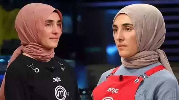 MasterChef Ayşe Ekizin estetikli görüntüsü olay oldu, sosyal medya ikiye bölündü