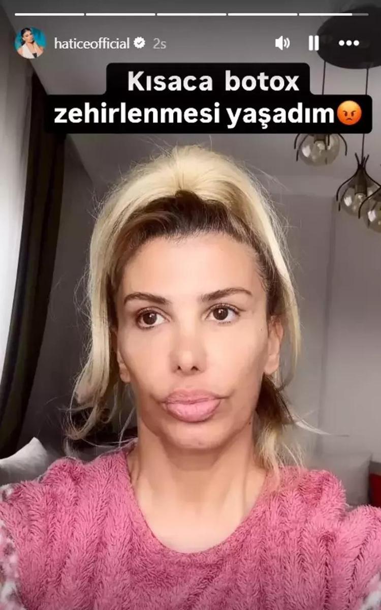 Şarkıcı Hatice botokstan tanınmaz hale geldi Paylaşımı korkuttu