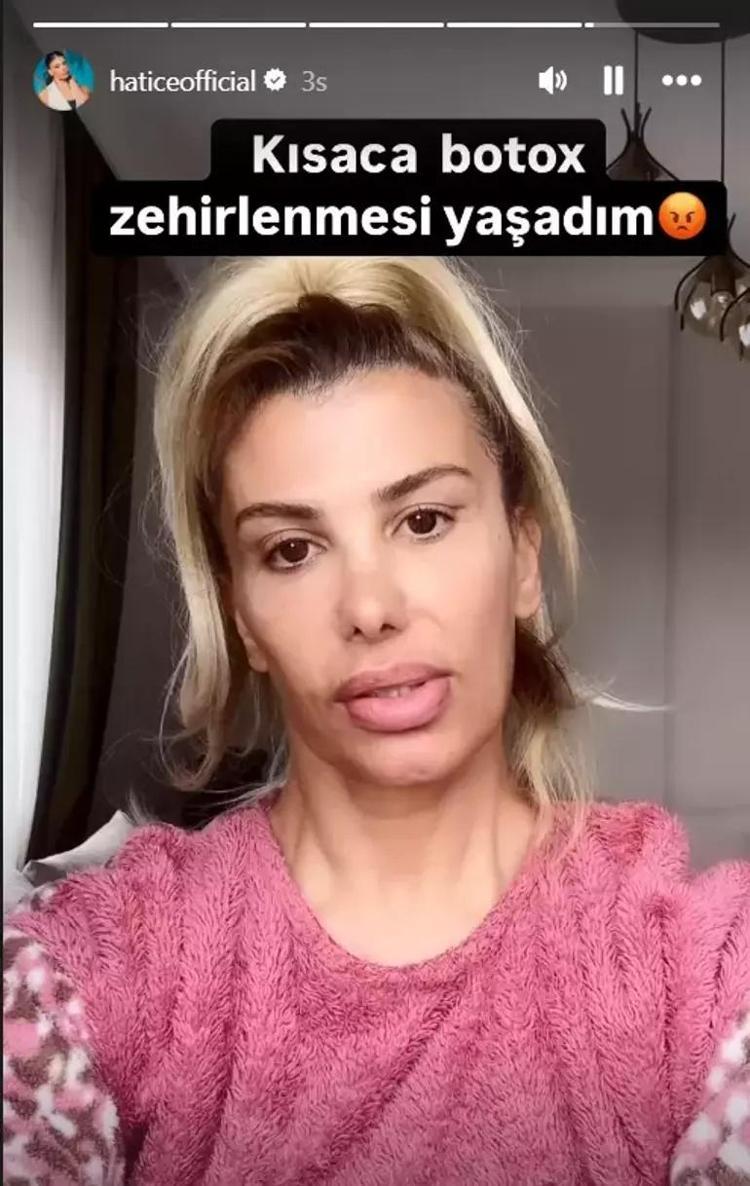 Şarkıcı Hatice botokstan tanınmaz hale geldi Paylaşımı korkuttu