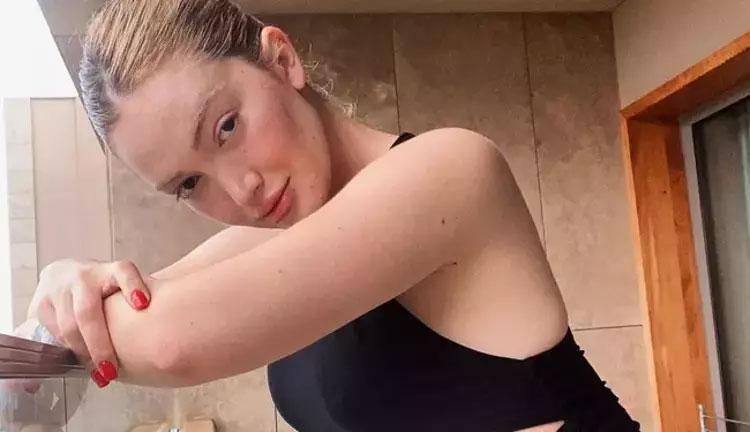 Danla Biliç eski sevgilisi tarafından darp edildi; KADESten yardım istedi