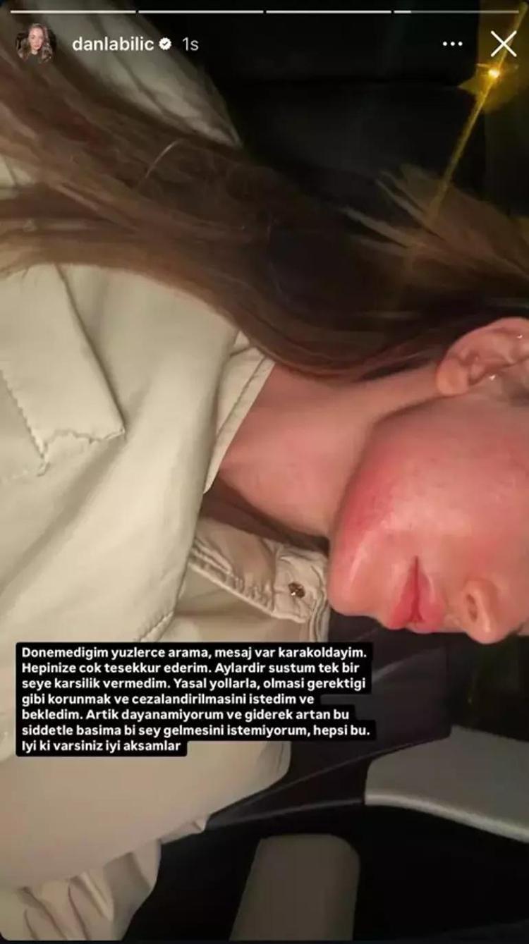 Danla Bilic bu kez darp fotoğrafını paylaştı