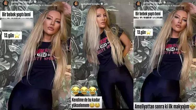 Gülşah Saraçoğlunun estetiği başına dert oldu Havalimanında zor anlar