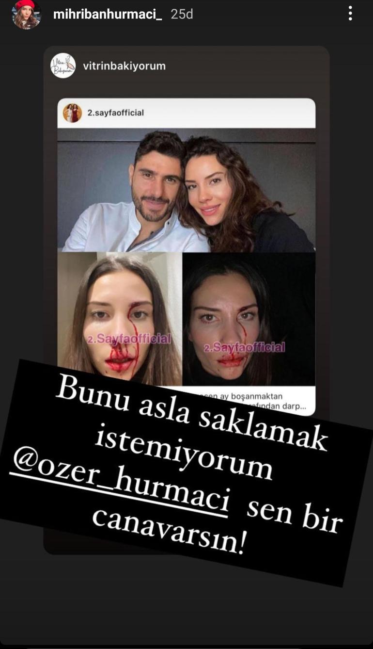 Futbolcu Özer Hurmacı eşini darp etti iddiası: Sen bir canavarsın